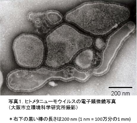 ヒトメタニューモウイルスの写真